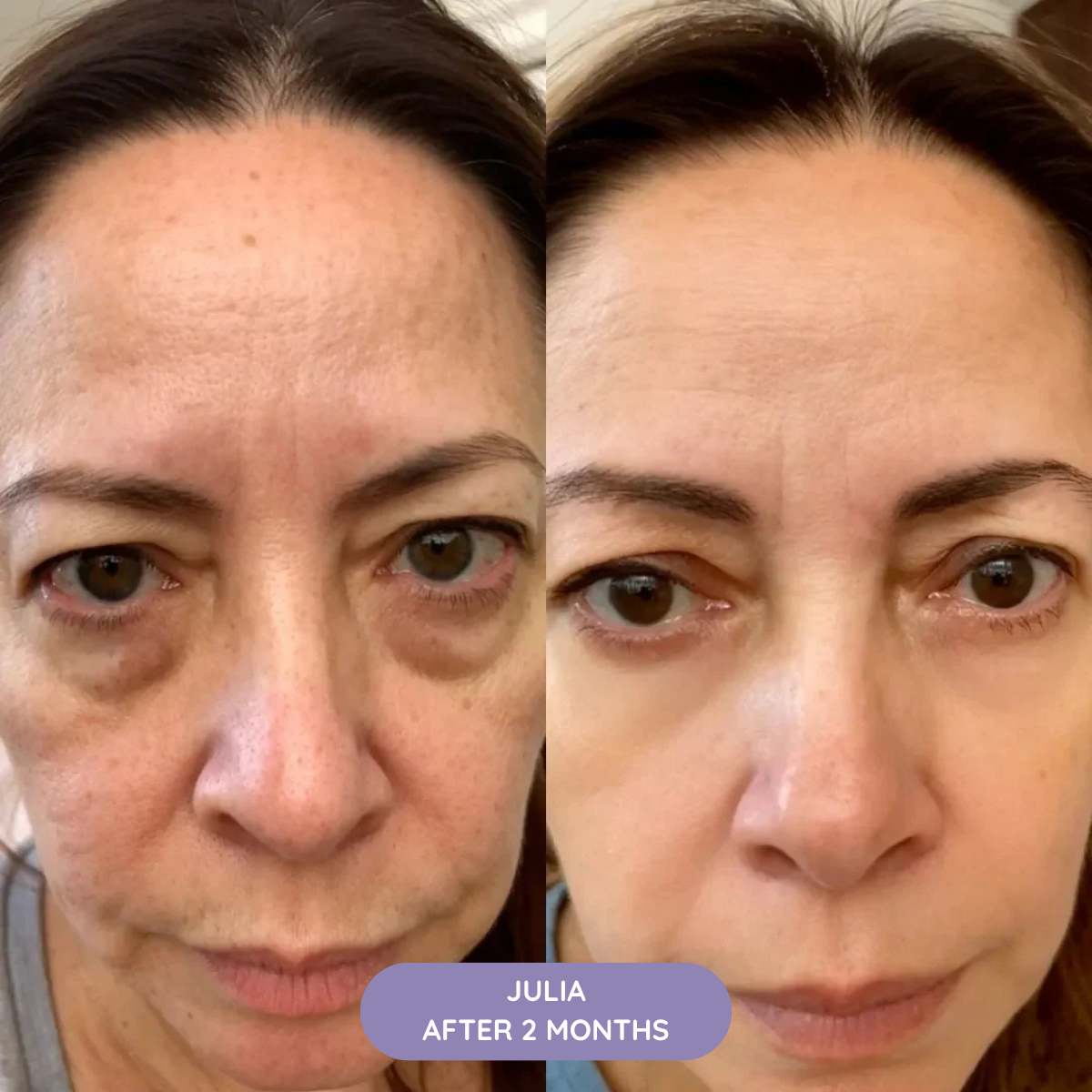 K-REVIVE – Lift, Brighten and Refresh in 10min/Day