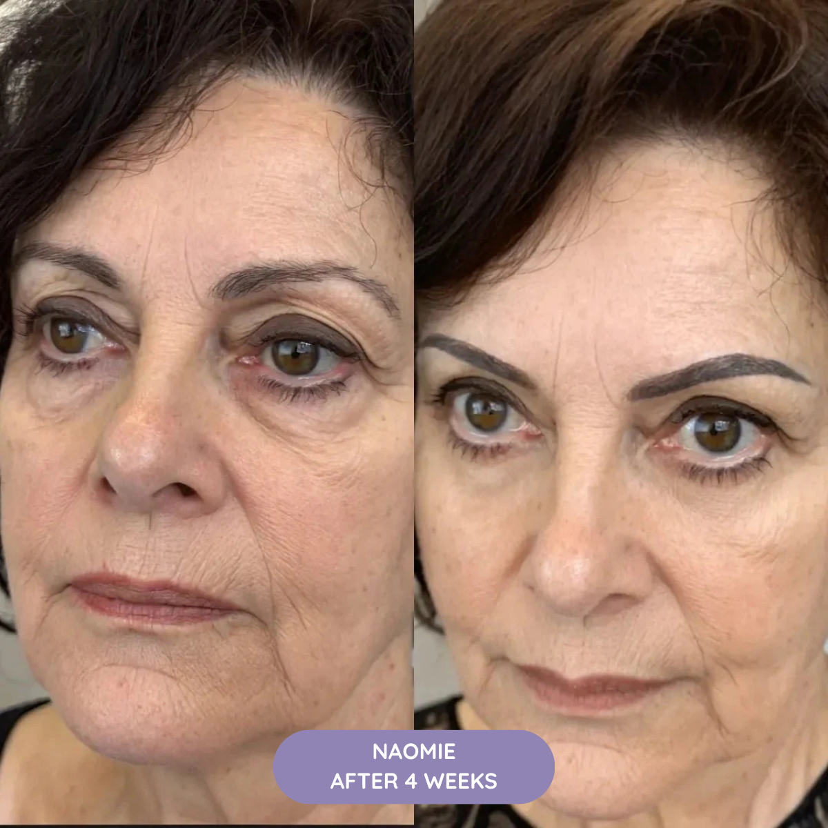 K-REVIVE – Lift, Brighten and Refresh in 10min/Day