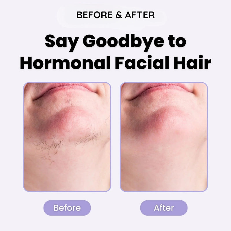 K-GLOW – Gentle hair removal for every skin.
