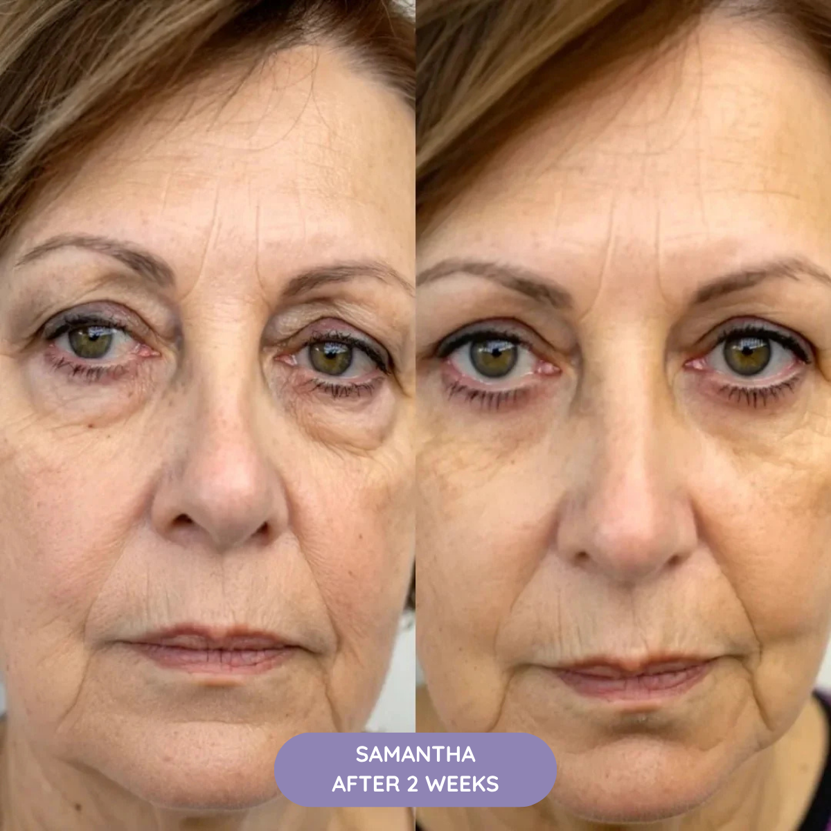 K-REVIVE – Lift, Brighten and Refresh in 10min/Day