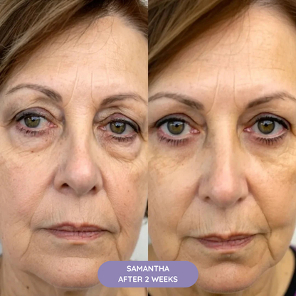 K-REVIVE – Lift, Brighten and Refresh in 10min/Day